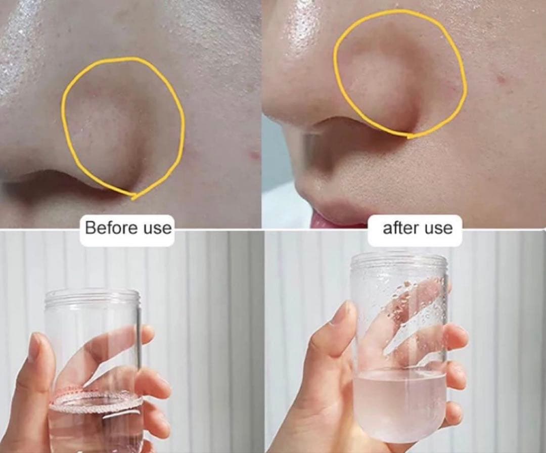 【新品】ハイドラフェイシャル おうちエステ　毛穴洗浄