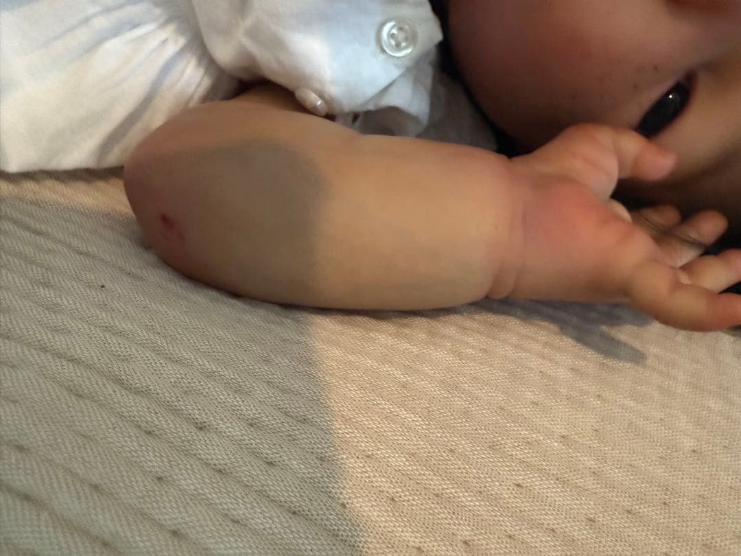 リボーンドール　そばかすちゃん