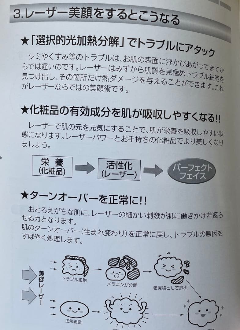 ラゼール レーザー美顔器 シミ シワ ニキビ くろずみ 対策 ケア ヤーマン制作