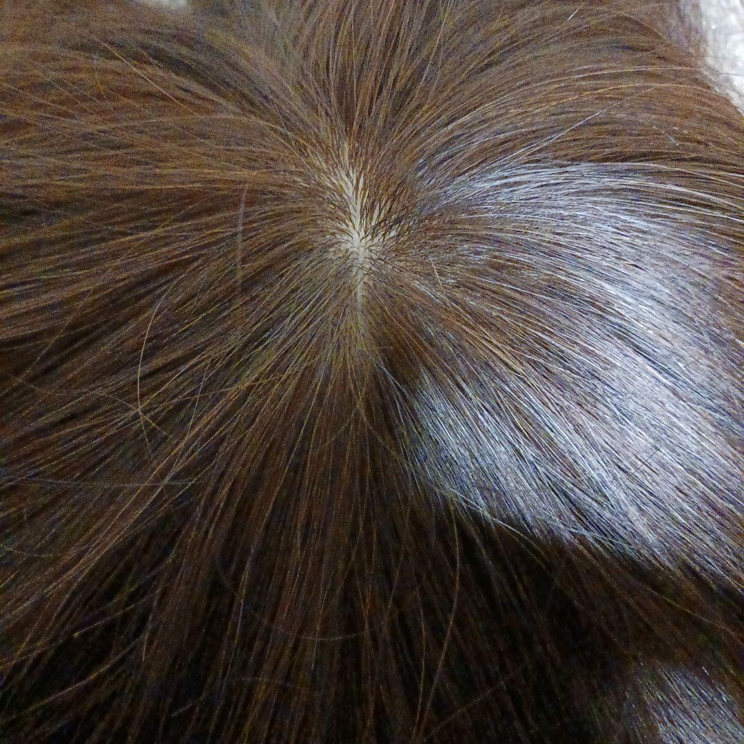 10日迄の限定価格★人毛(100%レミー使用) 総手植え医療用部分ウィッグ