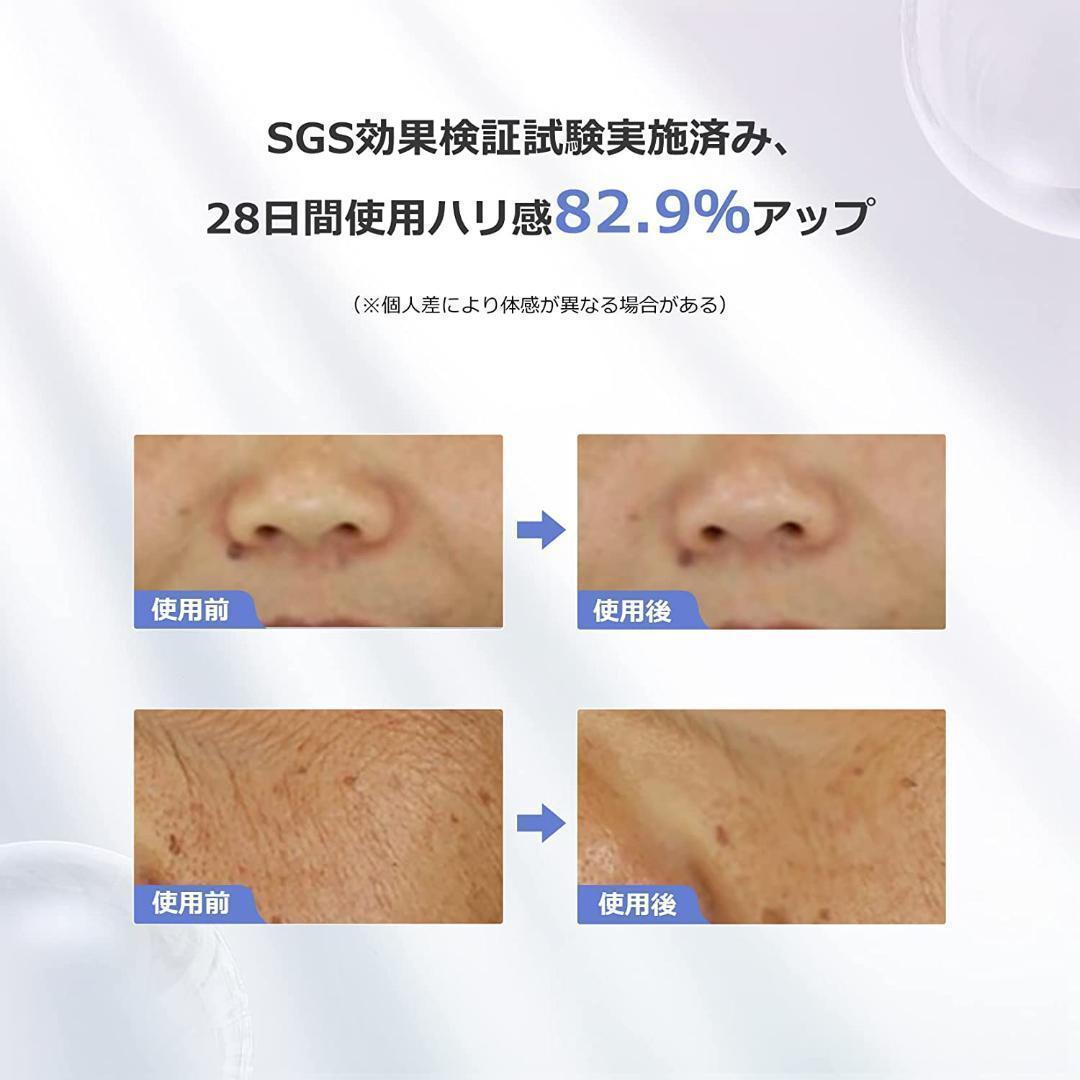 COSBEAUTY RF 美顔器　ラディアンス
