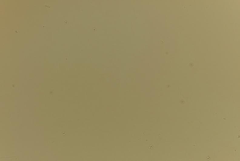 オリジナルセンサーID5　ライカ Leica M9 ブラックペイント LEICA