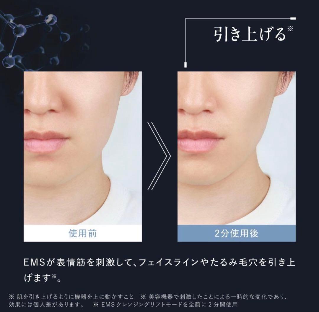 【新品】アンファー　EMS 電動 洗顔ブラシ 29700円　岩田剛典アンバサダー