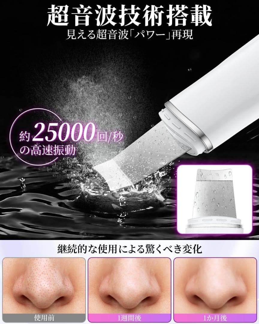 ウォーターピーリング 美顔器 多機能美顔器 超音波 ems イオン 自動電源オフ