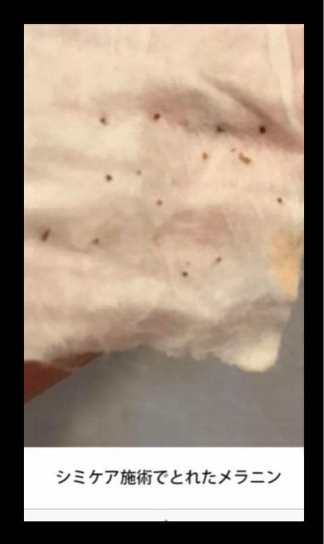 ◆イオナイザー◆業務用シミ取り