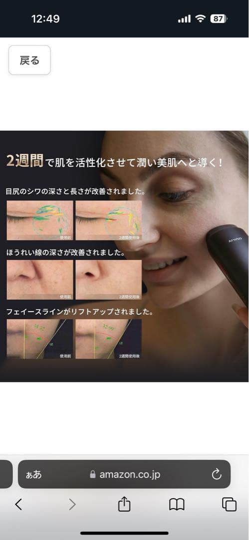 AMIRO R1 PRO フェイシャル RF 肌引き締めデバイス