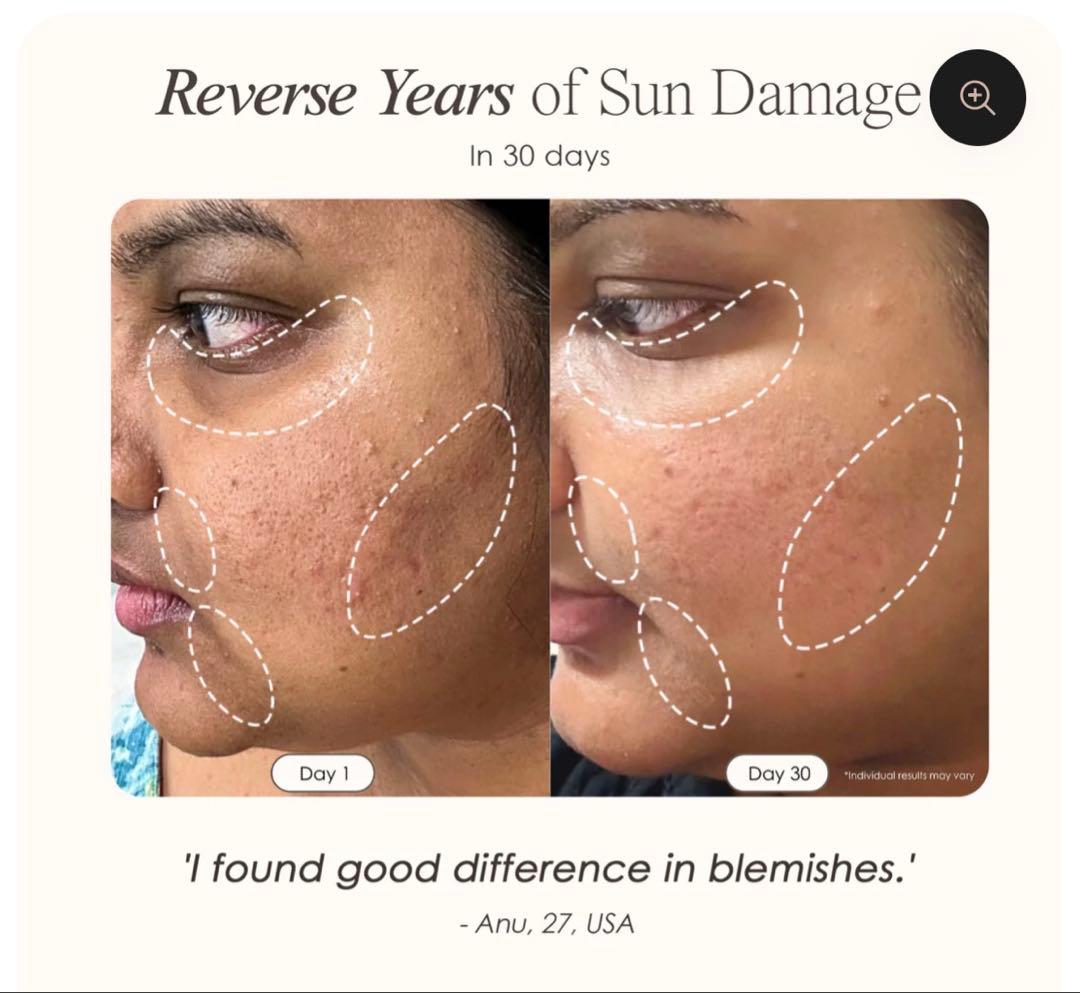 Project E beauty ワイヤレス LEDマスク 7色 イギリス輸入品