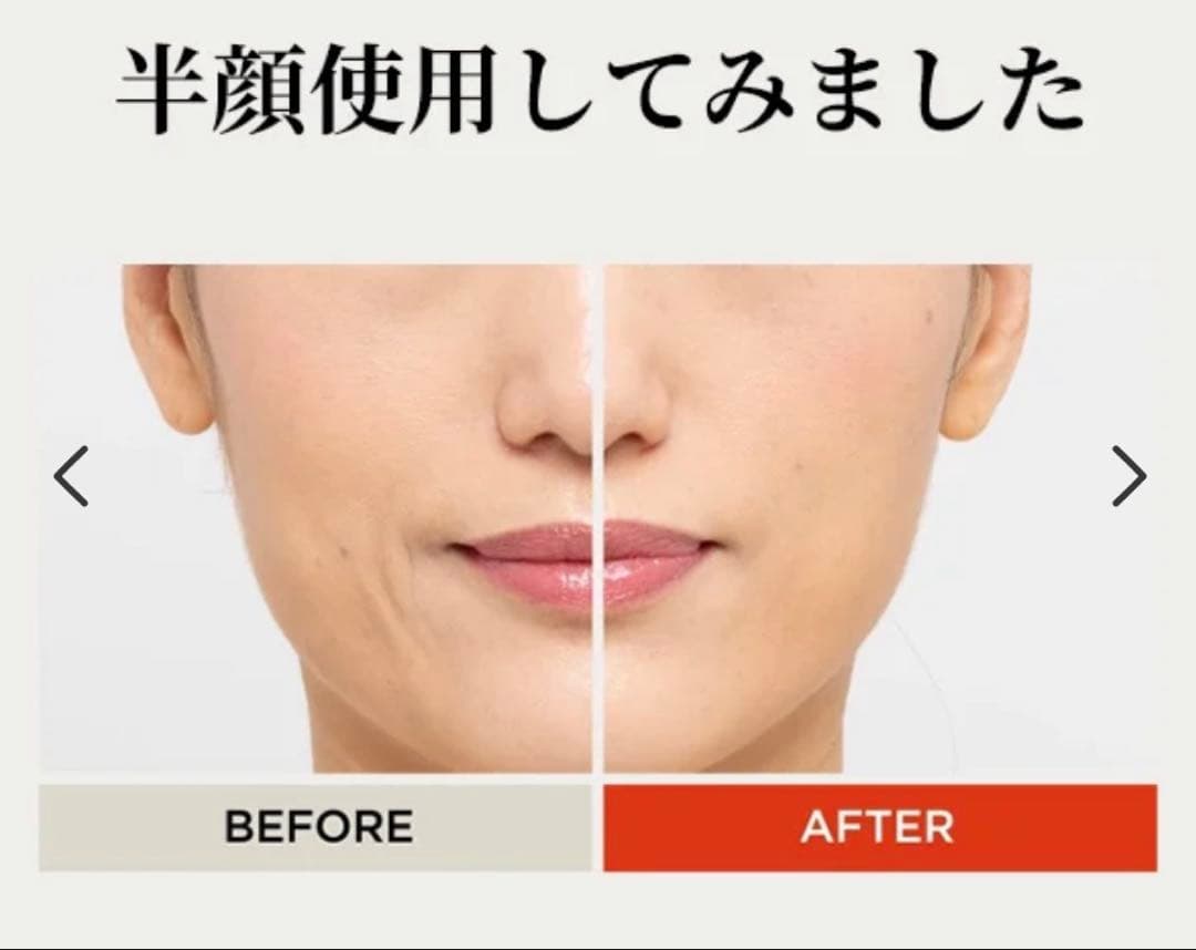 【美品】YAMAN リフトロジー 美顔器