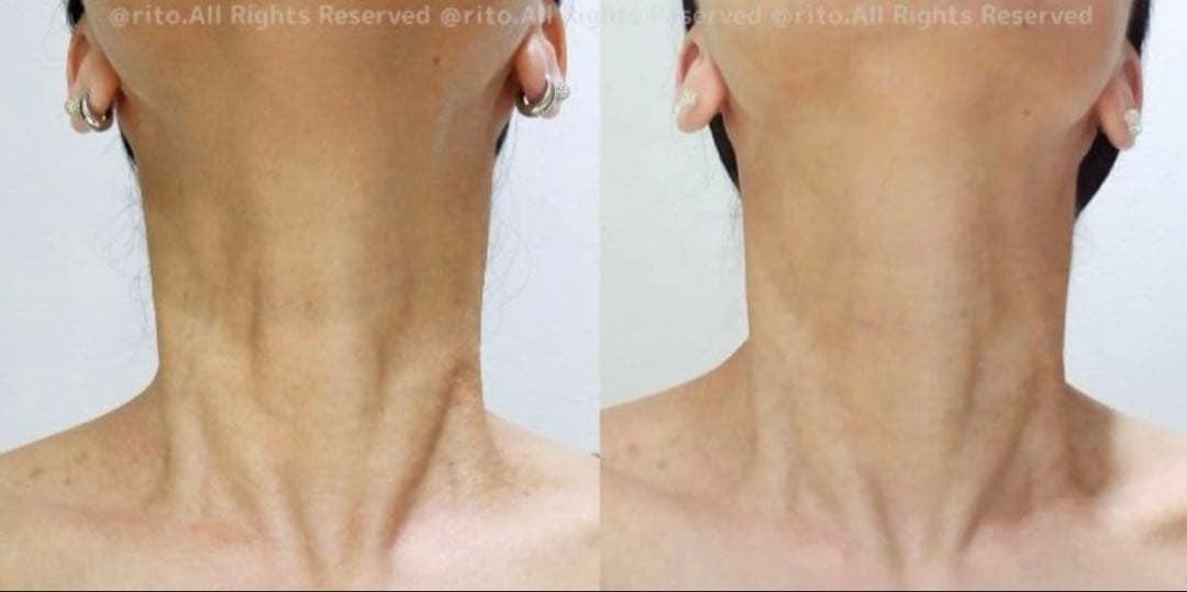 カレントボディ CURRENT BODY LEDデコルテ　ネック　首　美品