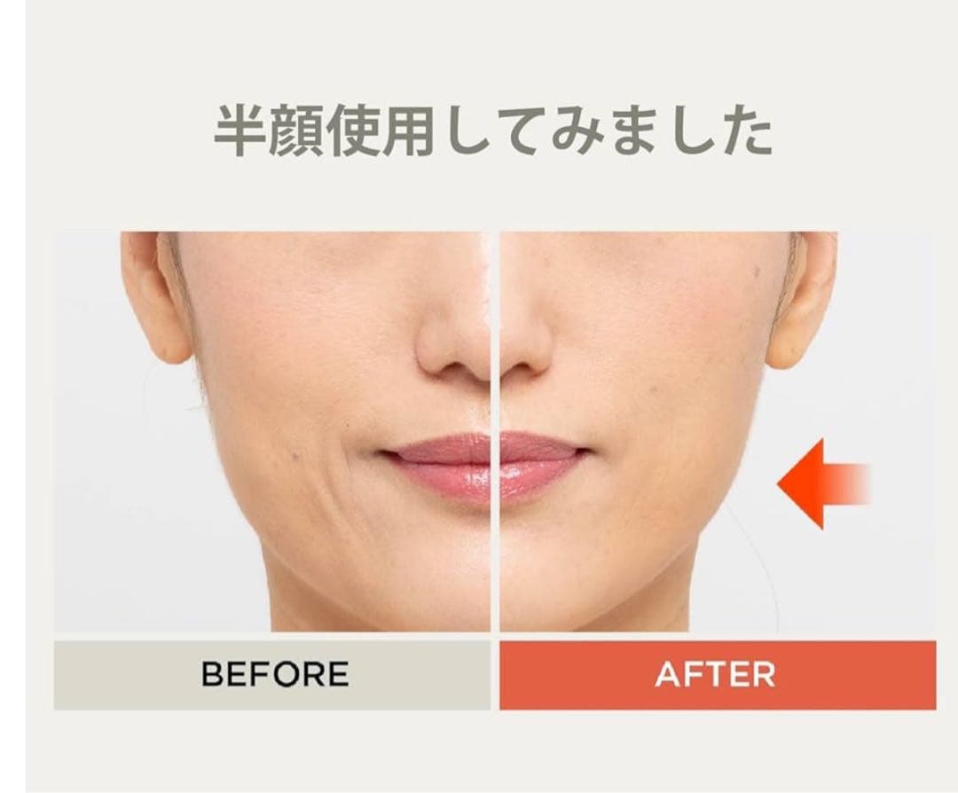 24年9月購入　YA-MAN リフトロジー標準タイプ