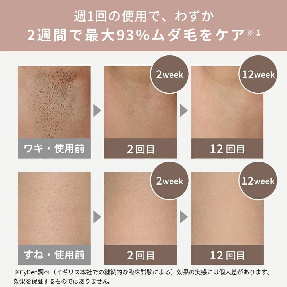 SMOOTHSKIN pure SWITCH IPL脱毛器 VIO対応【新品】