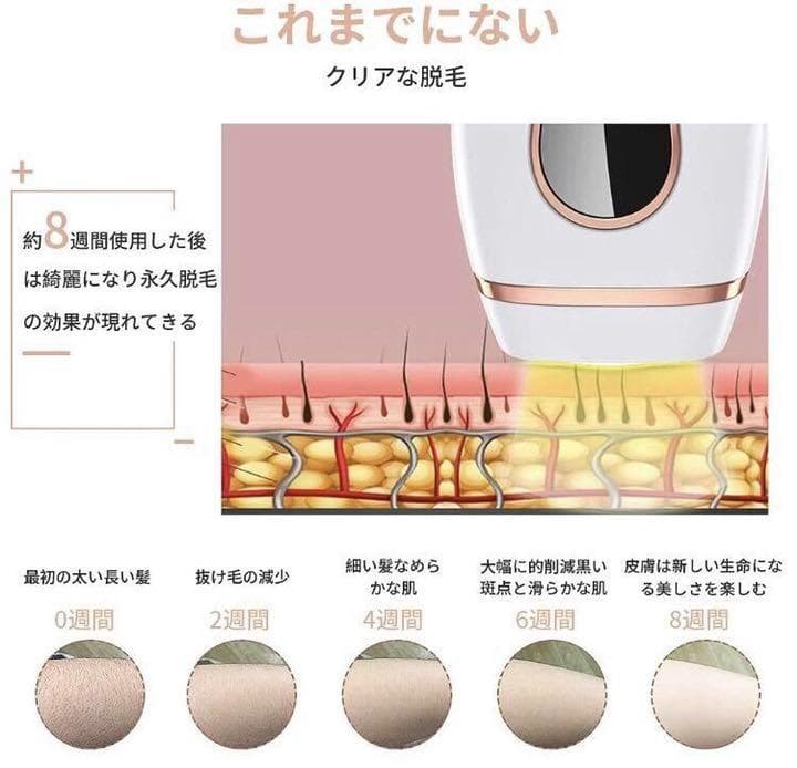 ❤99万回照射❣プロのIPL光エステ技術で100％安全安心♪❤IPL光脱毛器