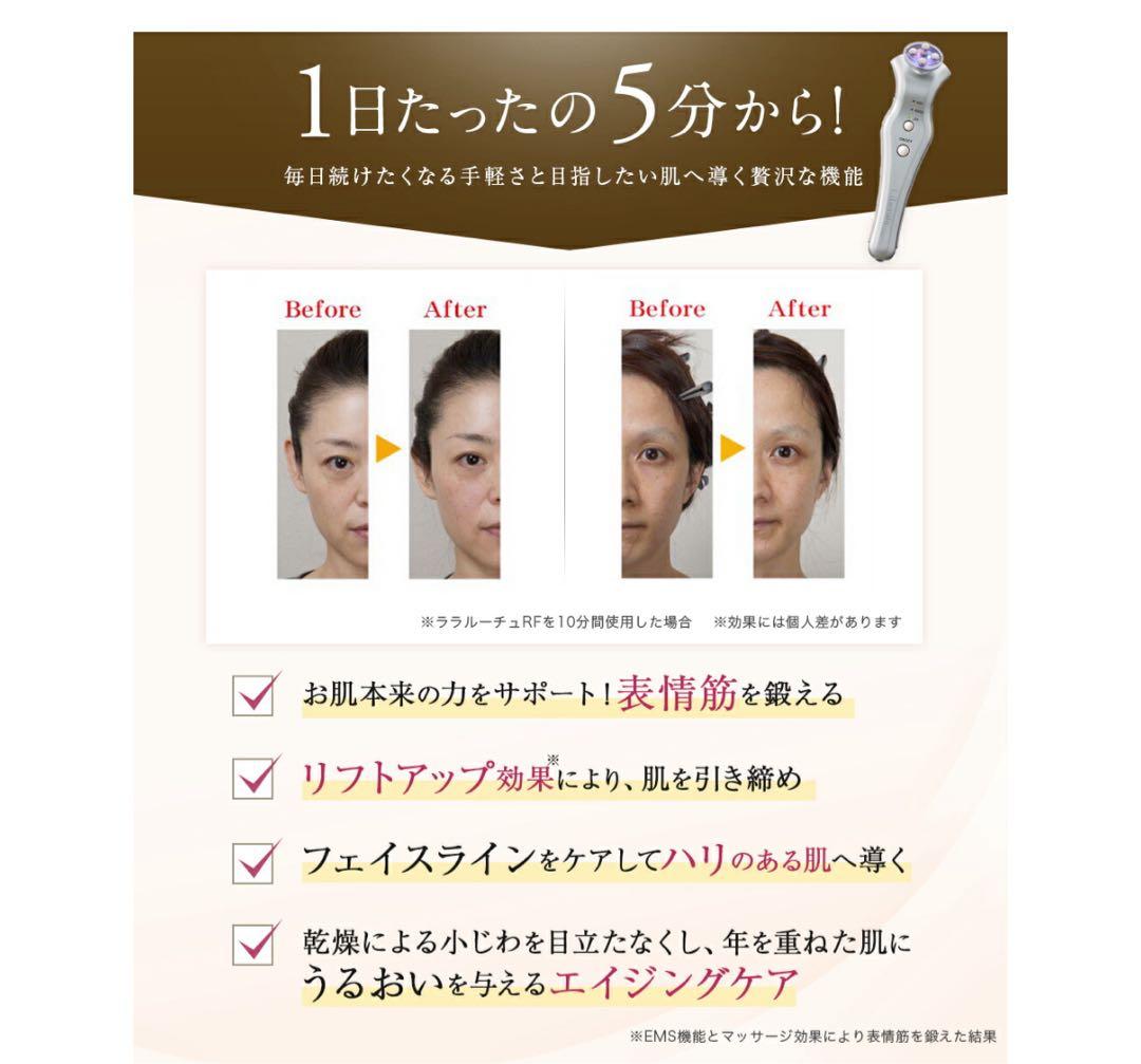 リベラータ　ララルーチュRF 美顔器