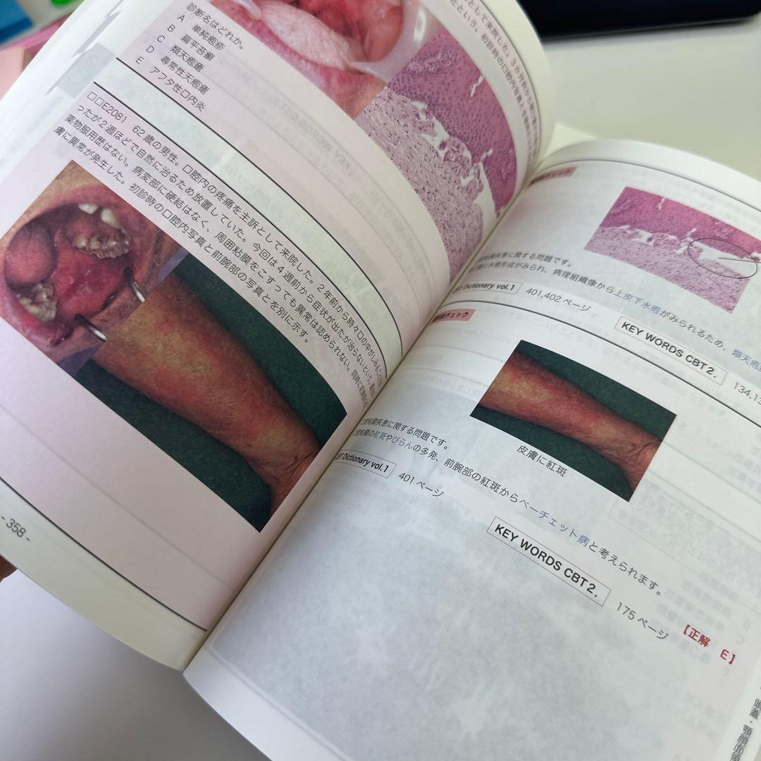CBT辞典　2016 美品