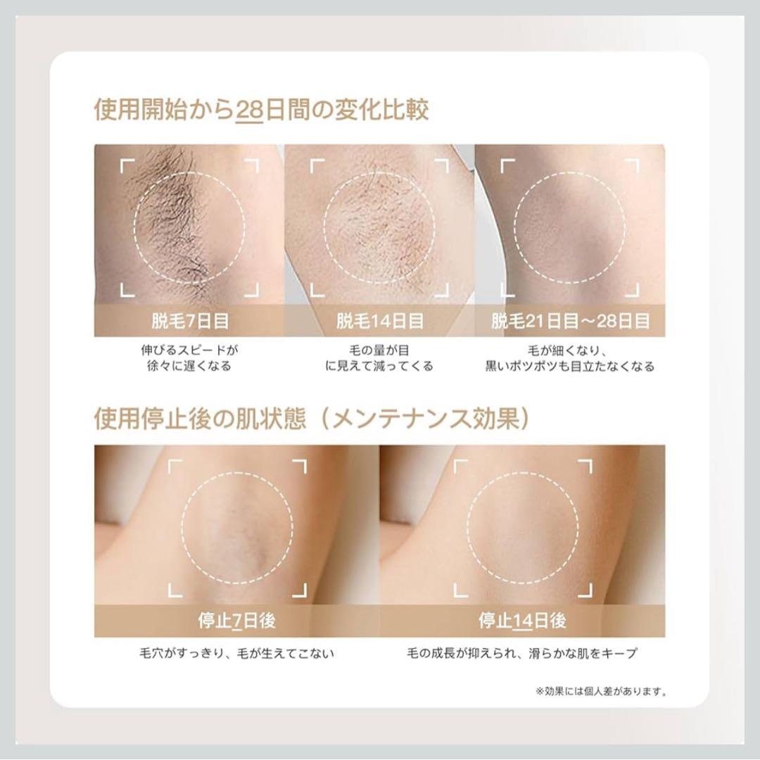 【Yete】脱毛器 家庭用脱毛器 IPL光脱毛器 冷感脱毛 無限照射回数