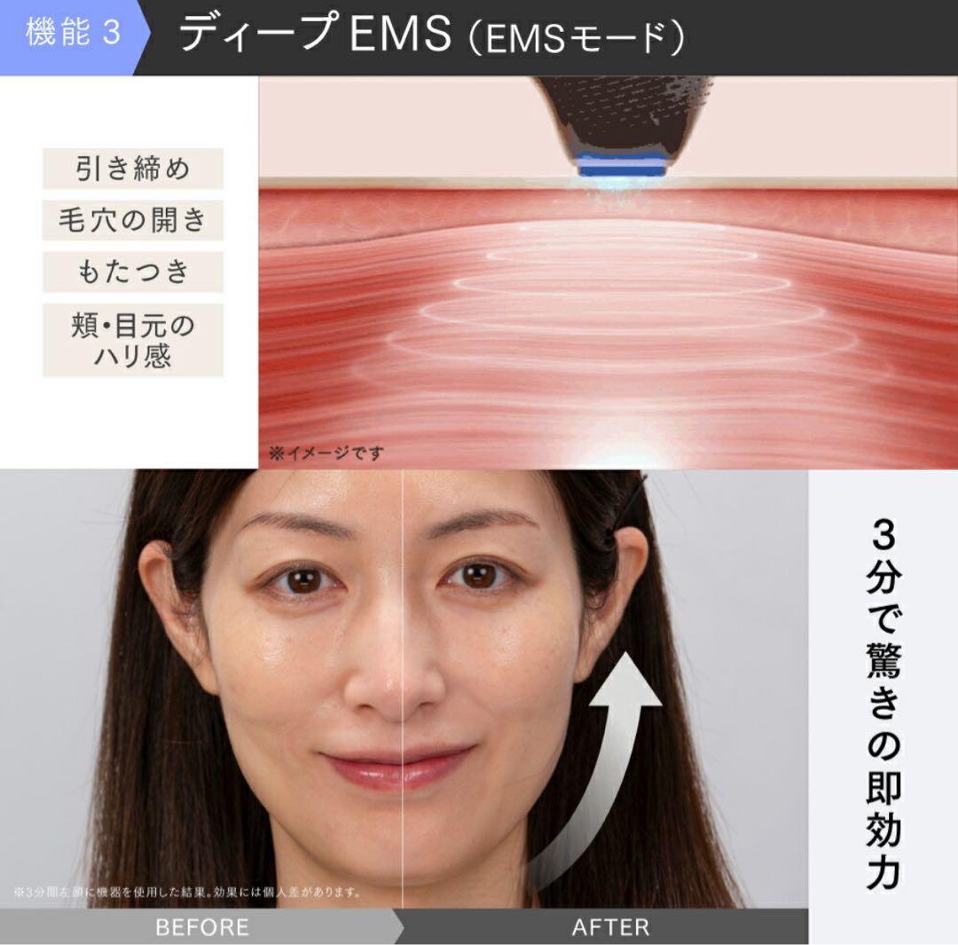 MYTREX MiRAY ONE マイトレックス　ミライワン光美容器　美容ゲル付