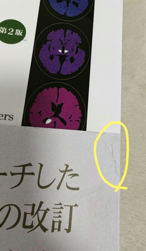 脳血管障害と神経心理学　第2版