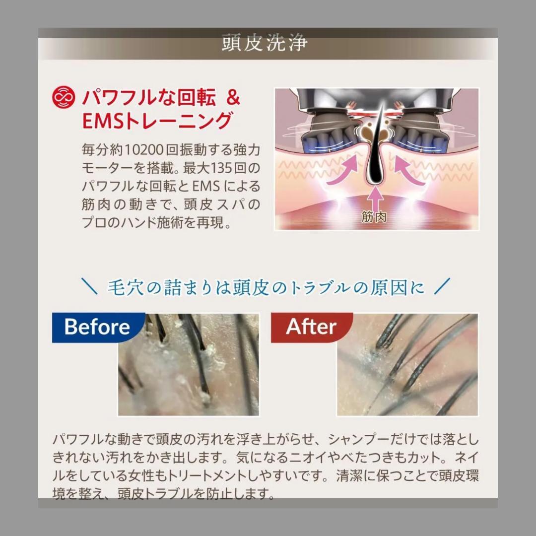 頭皮ケア特化のEMS×回転ヘッドスパマシーン『ゾーガンキンスカルプ』