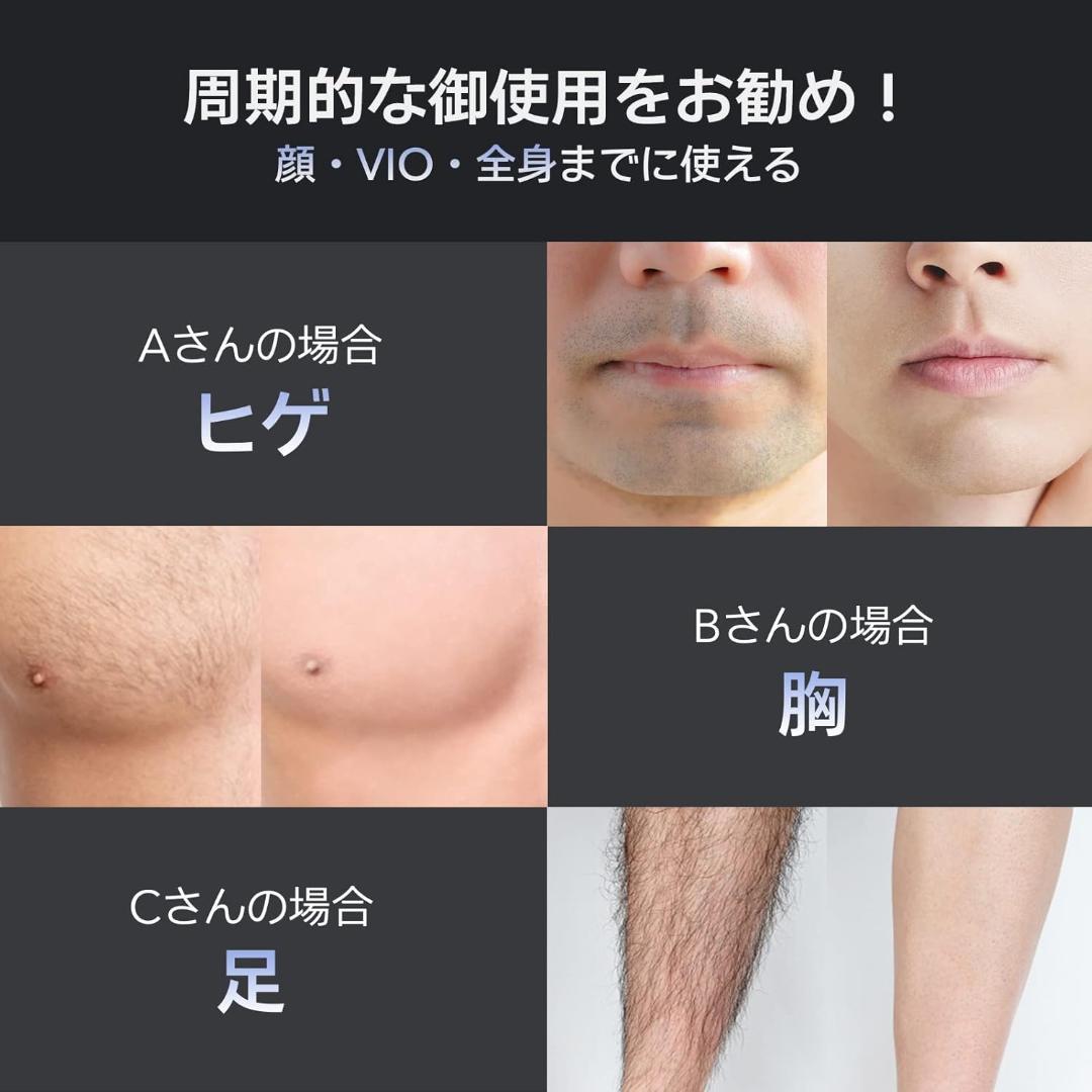 【正規品】Ulike メンズ脱毛器 Air2 サファイア冷感技術 全身脱毛対応