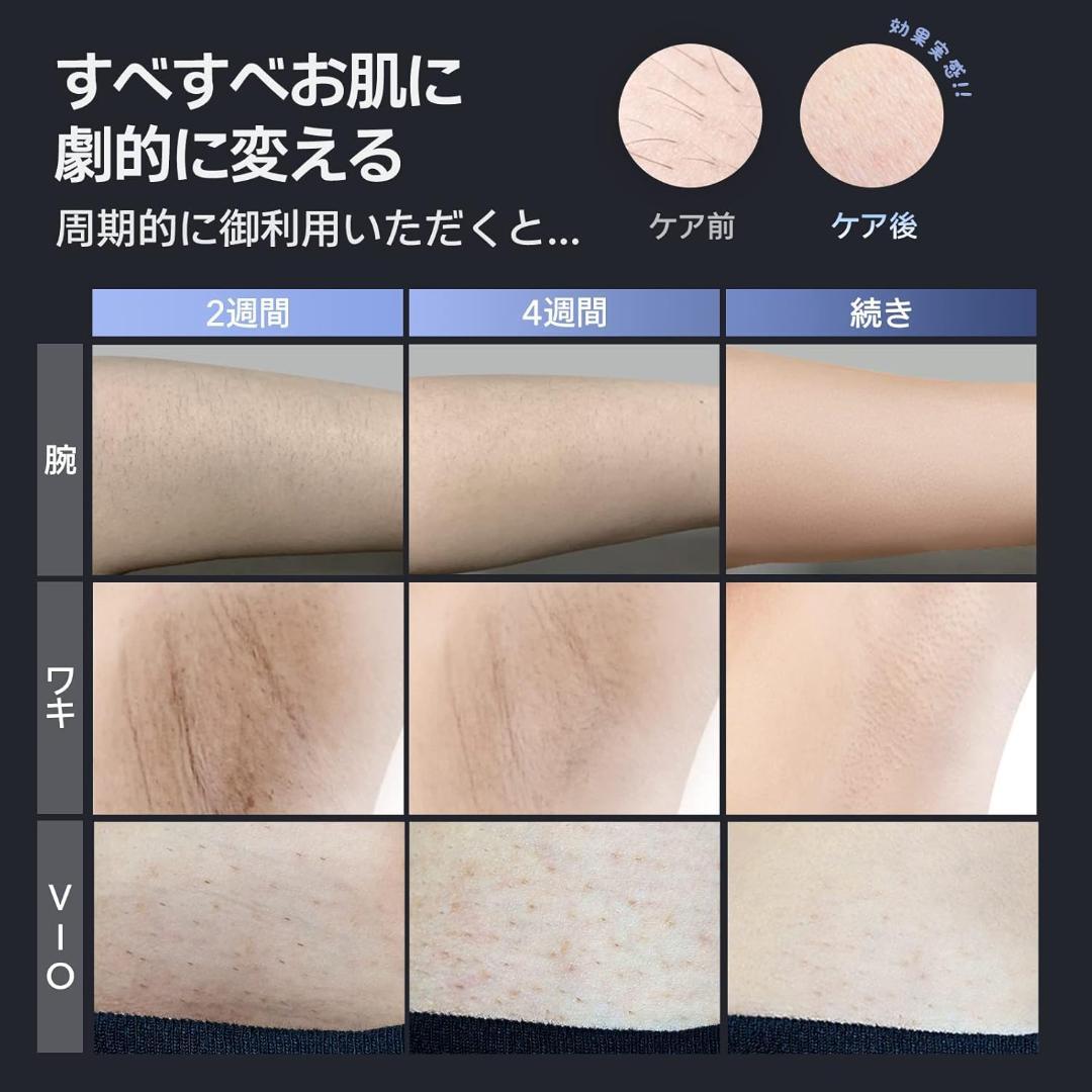 【正規品】Ulike メンズ脱毛器 Air2 サファイア冷感技術 全身脱毛対応