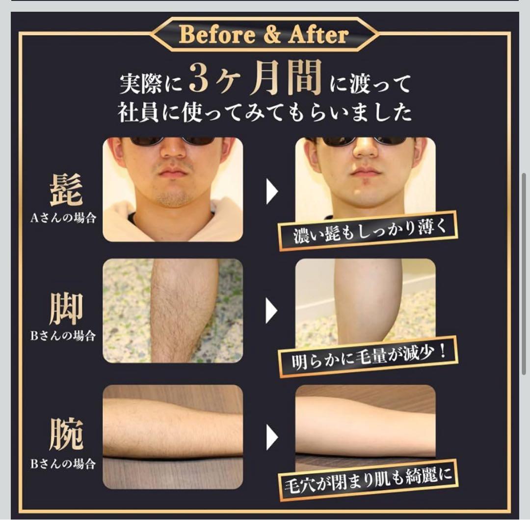 M1109  CLEAR MCLEAR メンズクリア 脱毛器 美容機器