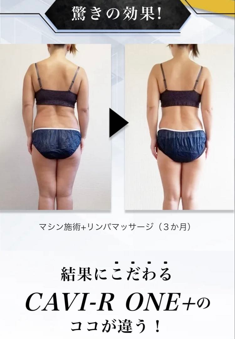 【ほぼ未使用】CAVI-R ONE+ 美顔器 キャビアールワンプラス！