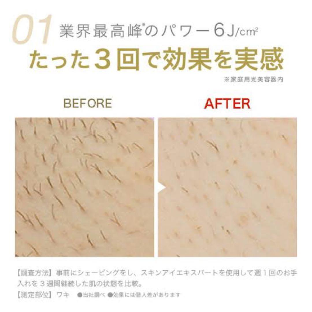 ブラウン(脱毛器)