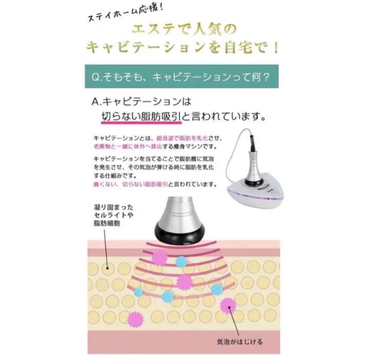 家庭用キャビテーション