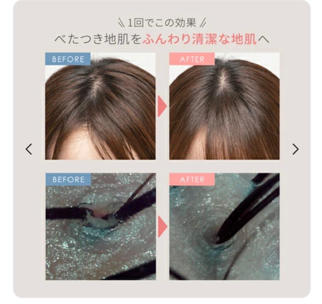 【新商品】定価29700円! ミーゼ　ニードルヘッドスパ EMS MS-33W