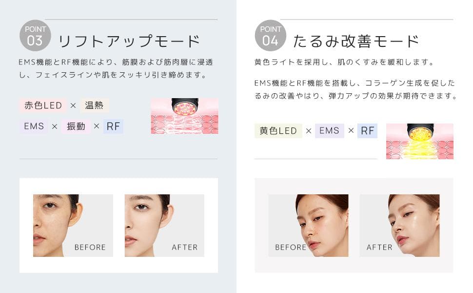美顔器 EMS 美容器 RF美顔器 自宅エステ 目元美顔器 多機能美容器