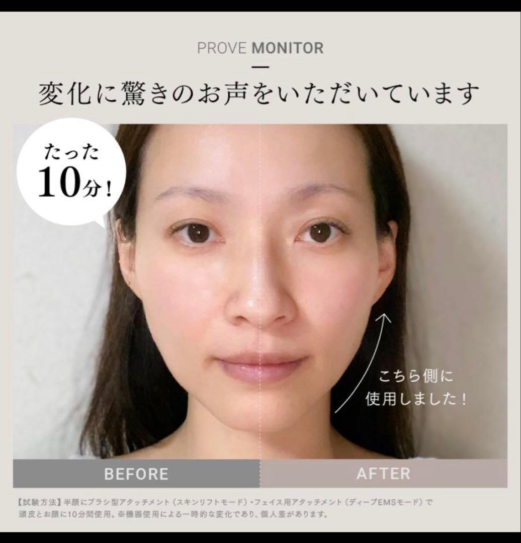 EMS MYTREX美顔器 専用ケース付き