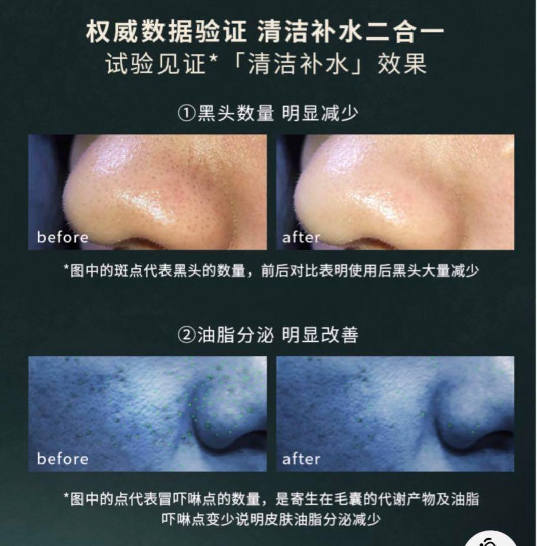 ハイドロスプラッシュ ハイドラフェイシャル