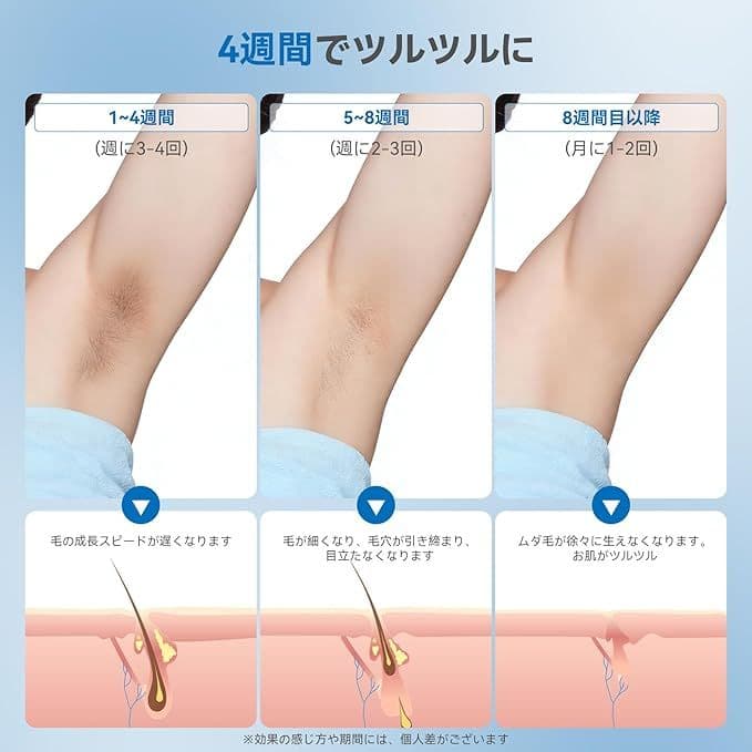 脱毛器 vio家庭用　脱毛器　自動/手動照射モード　全身対応　男女兼用 光美容器