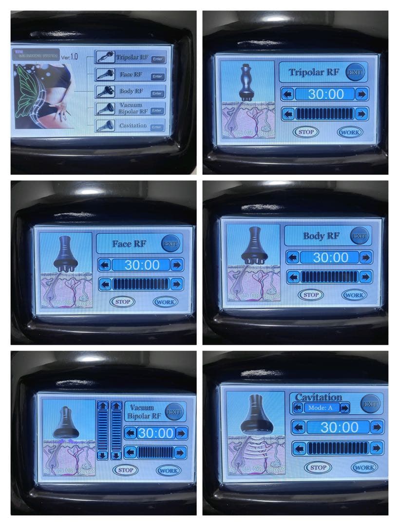 家庭・業務用40Khzキャビテーション＋ラジオ波+バキューム