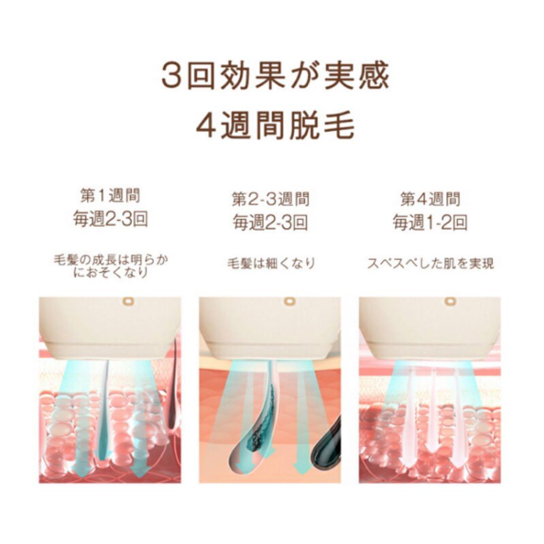 ビューティゴ 脱毛器 男女兼用 VIO対応 無痛脱毛 ヒゲ脱毛 無駄毛処理 美容