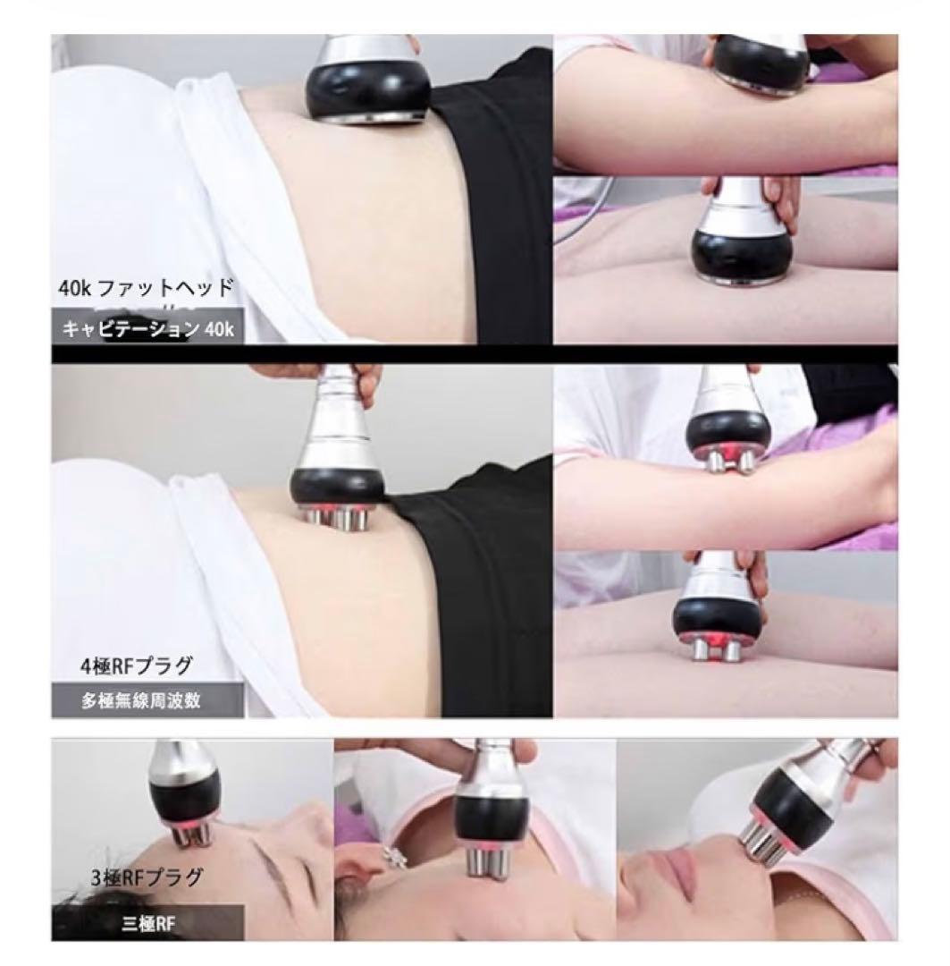 40KHZ キャビテーション+光ラジオ波