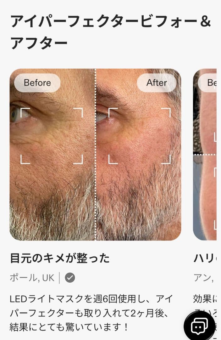 ボディ・フェイスケア CURRENTBODY LED EYE PERFECTOR