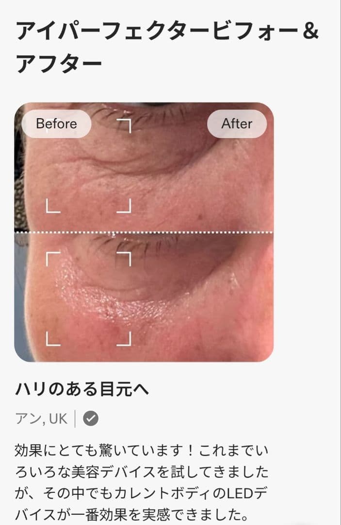 ボディ・フェイスケア CURRENTBODY LED EYE PERFECTOR