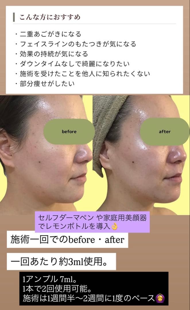 Jewel333　レモンボトル×３本