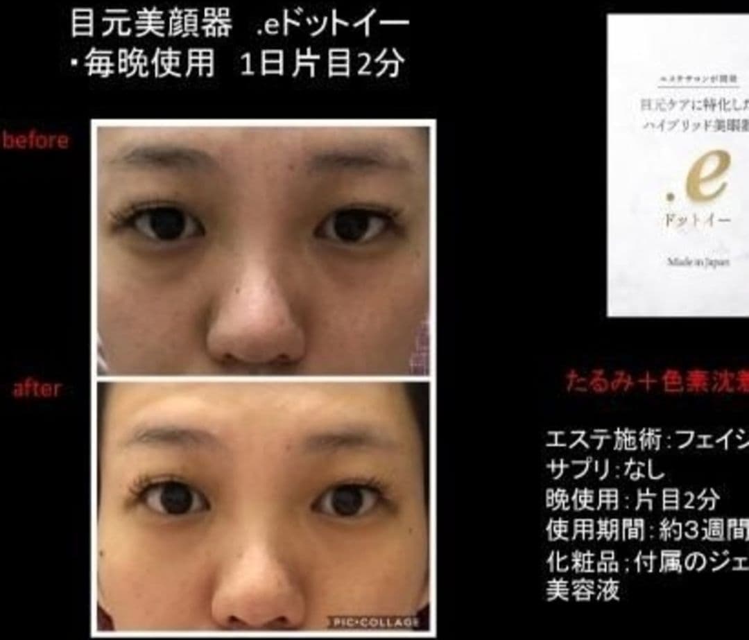 ドットイー 目元専用美顔器