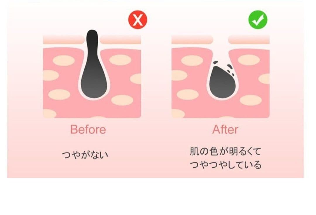 ★値下げ★LED美顔器　光照射　美白　ニキビ　ハリ　育毛