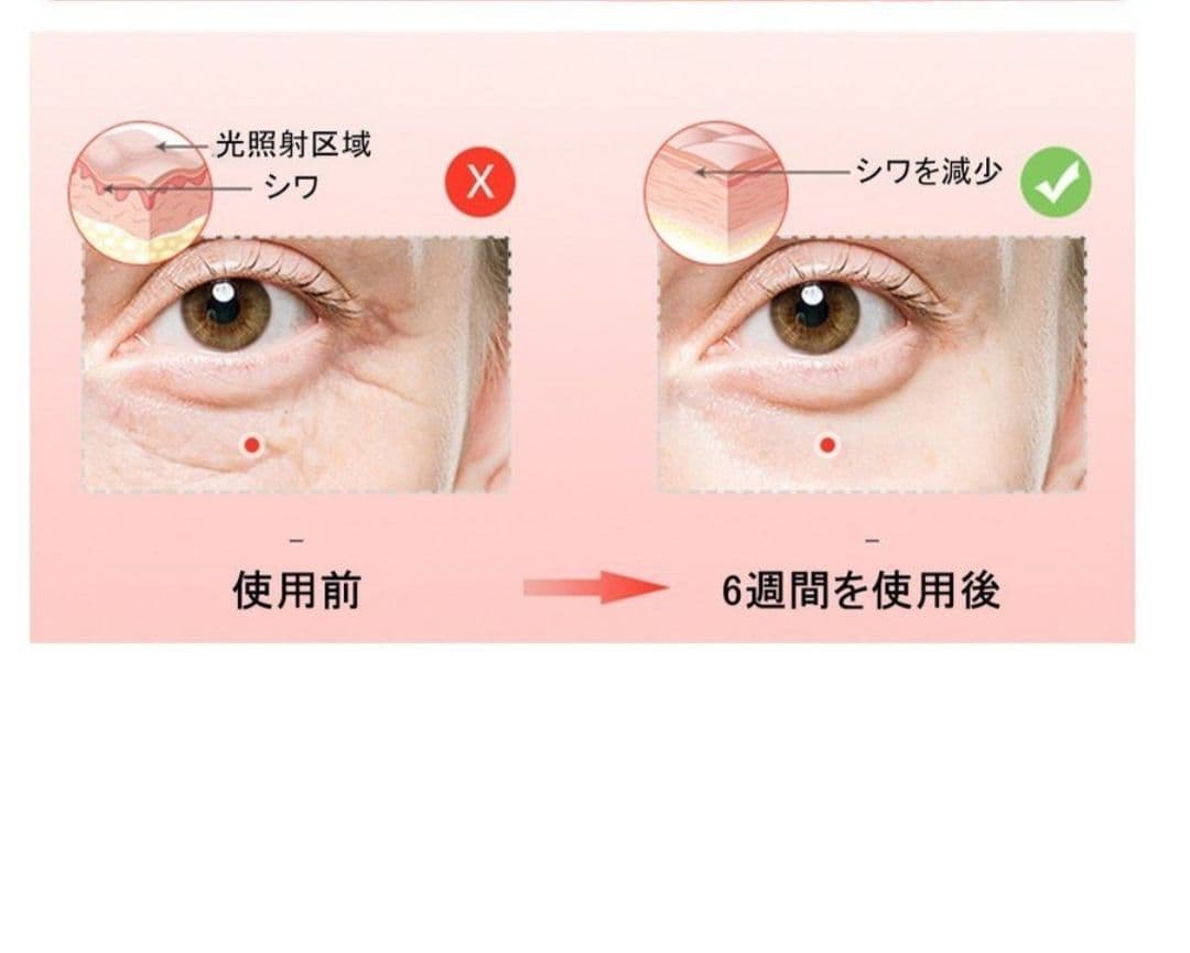 ★値下げ★LED美顔器　光照射　美白　ニキビ　ハリ　育毛