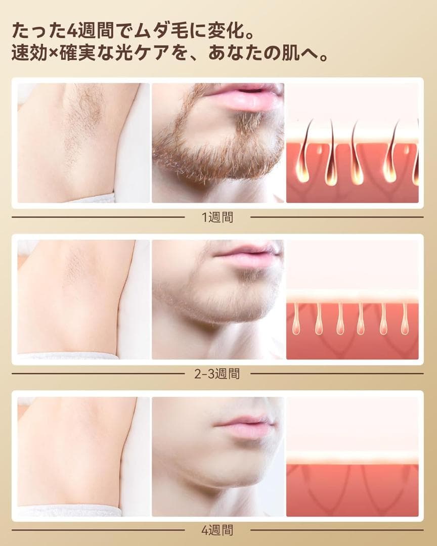 K080 冷感脱毛器 VIO対応 1台3役 サロン級冷感脱毛器 IPL光脱毛器