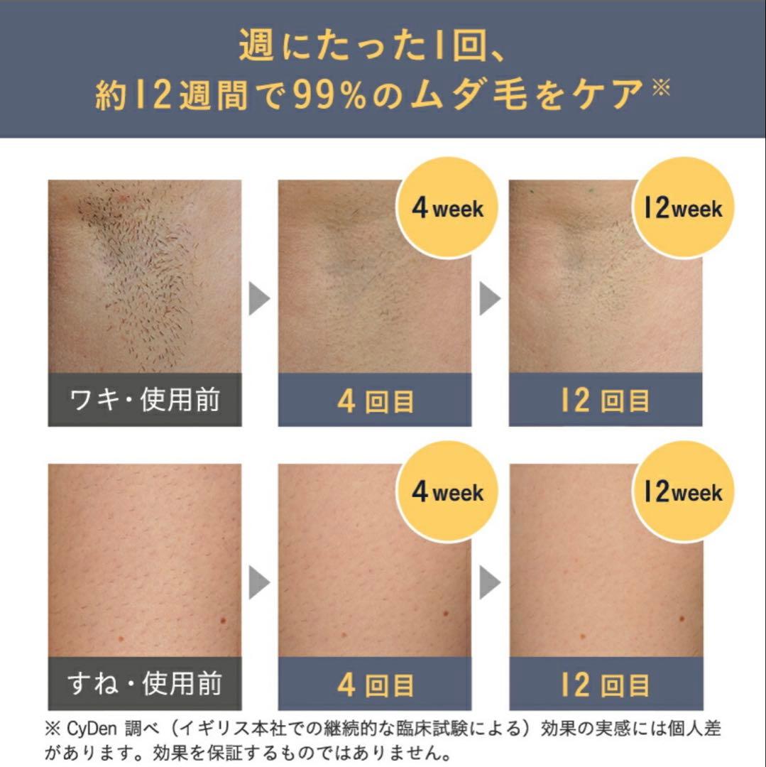 脱毛器 pure unplugged SMOOTHSKIN 公式ストア購入品