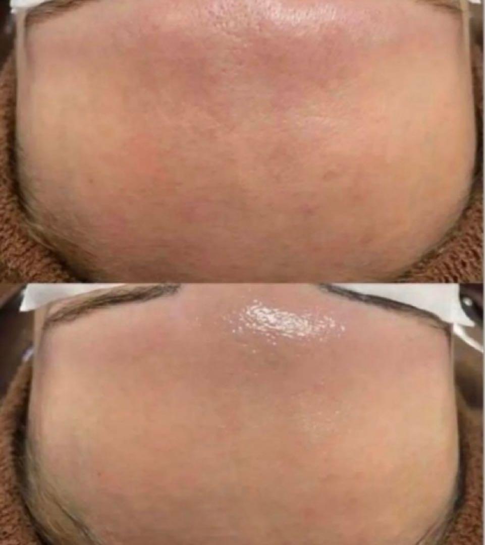 【即日発送】ララピール・洗顔★Foam ★BASIC ★ULTRA