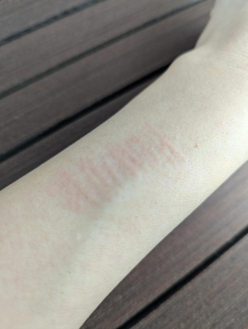 tria トリア スキン エイジングケアレーザー 美顔器