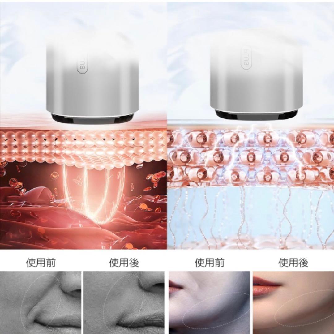 【1台多役⭐️】美顔器 EMS 目元美顔器 目元ケア 肌ケア 口元ケア 顔