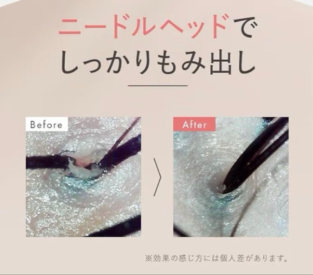 MUSTEM 家庭用美容器ヘッドスパ　EMS 揉み出しアタッチメント付き￼