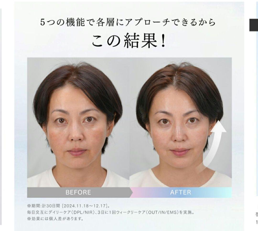 ☆新品未開封☆ 最終価格　MYTREX MiRAY ONE ホワイト 美顔器