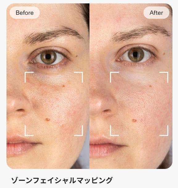 【未使用Currentbody Skin LED 4イン1 マスク＋マスク5枚